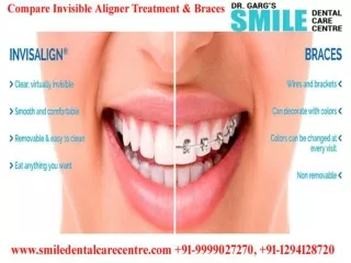 Best Invisible Aligner Treatment in Faridabad at Orthodontic Dental Clinic