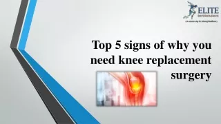 Top 5 signs of why you need knee replacement surgery