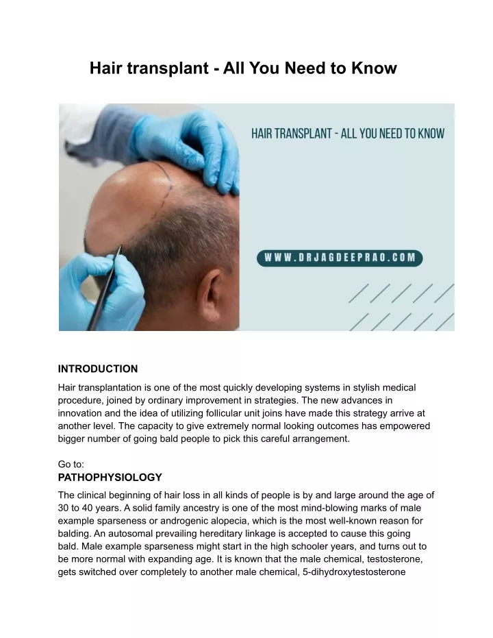 hair transplant all you need to know