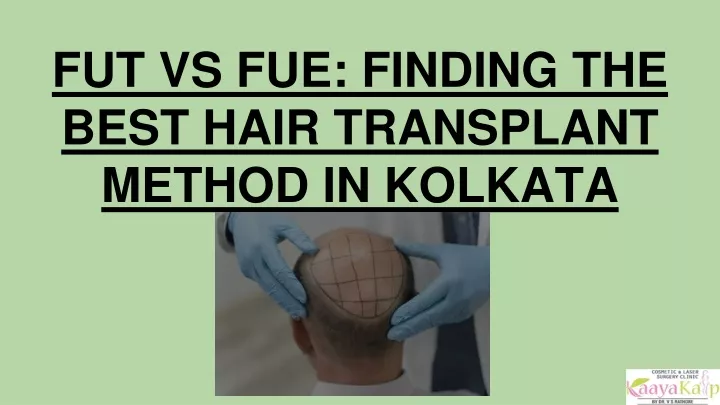 fut vs fue finding the best hair transplant method in kolkata