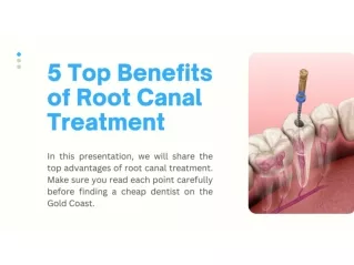 5 Top Benefits of Root Canal Treatment