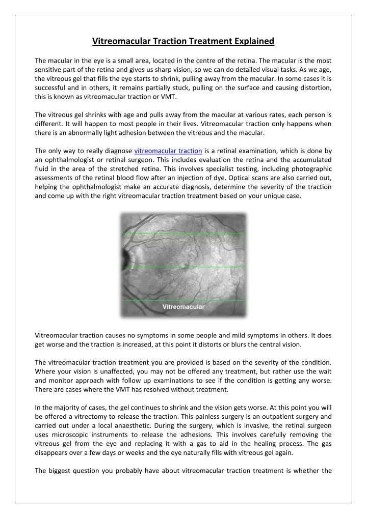 vitreomacular traction treatment explained