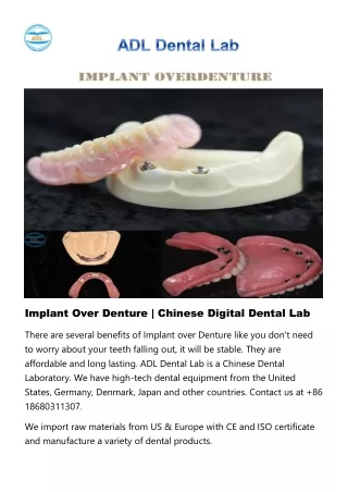 Implant Over Denture - Chinese Digital Dental Lab