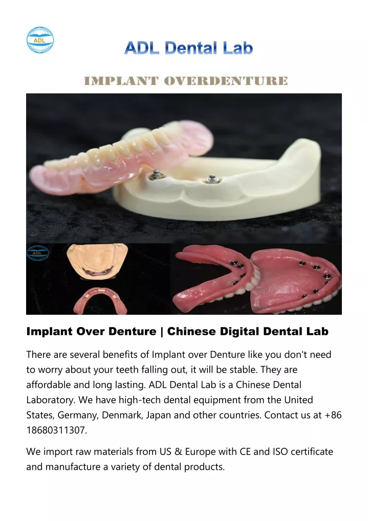 implant over denture chinese digital dental lab