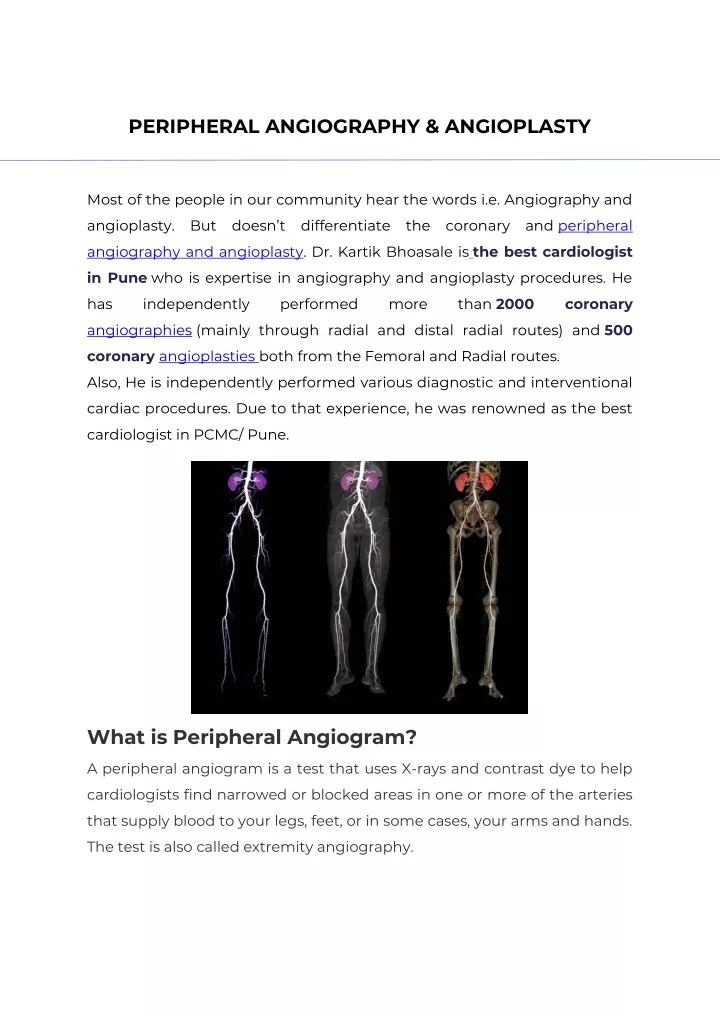 peripheral angiography angioplasty