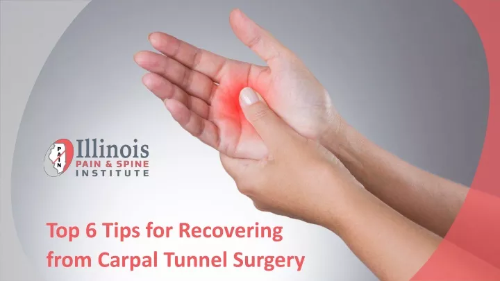 top 6 tips for recovering from carpal tunnel
