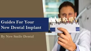 Guides For Your New Dental Implant