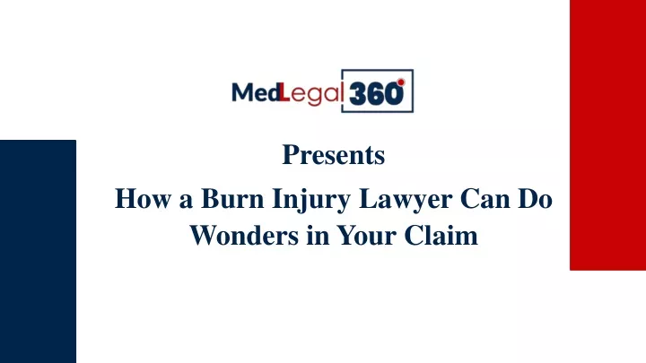 presents how a burn injury lawyer can do wonders