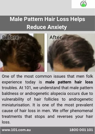 Male Pattern Hair Loss Helps Reduce Anxiety