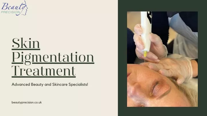 skin pigmentation treatment advanced beauty