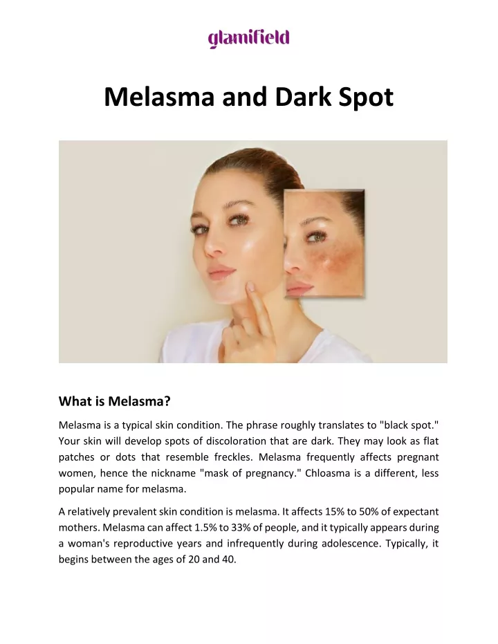 melasma and dark spot