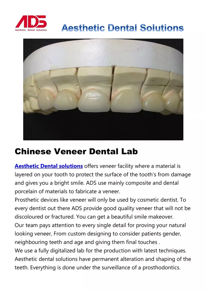 chinese veneer dental lab aesthetic dental