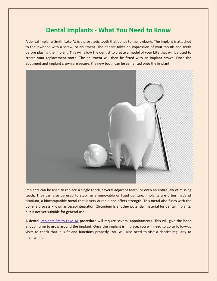 Ppt Dental Implants What You Need To Know Powerpoint Presentation Free Download Id