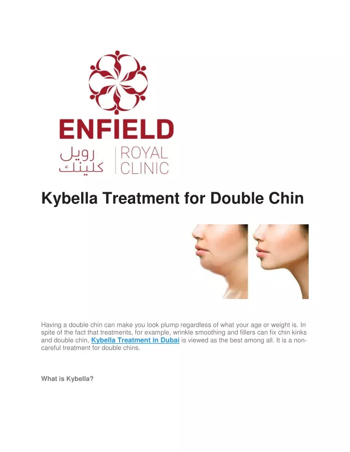 kybella treatment for double chin