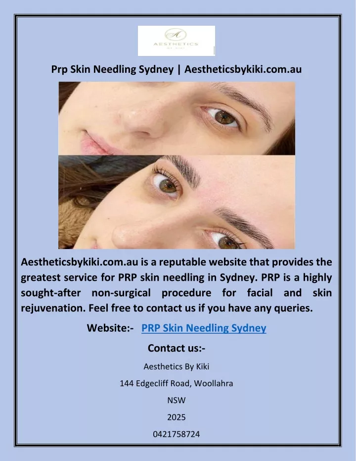 prp skin needling sydney aestheticsbykiki com au