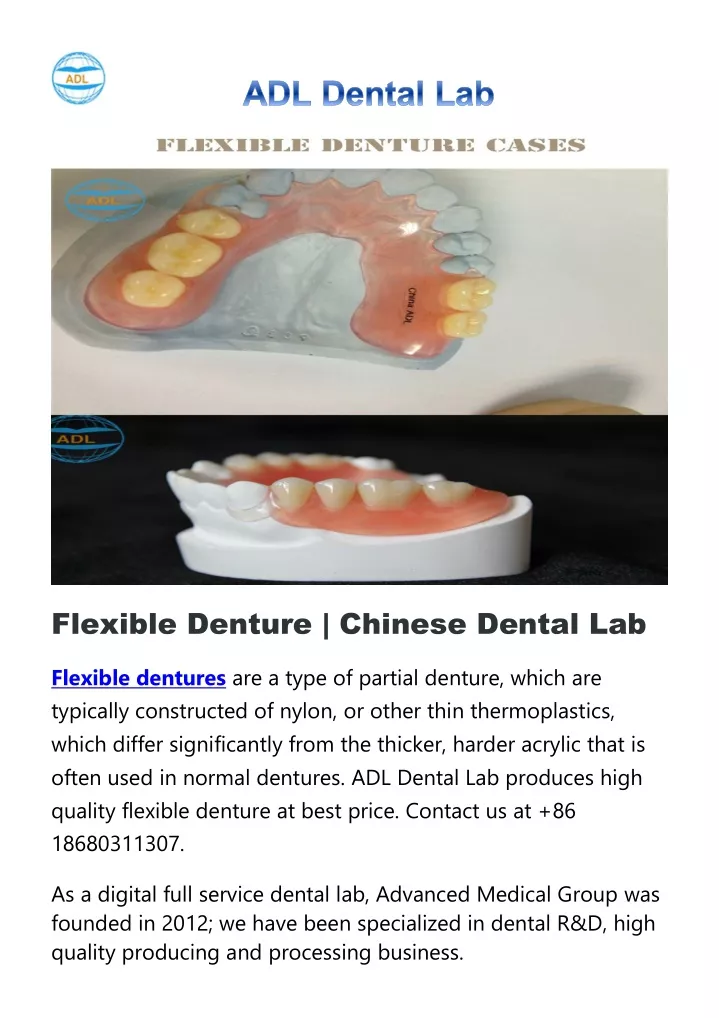 flexible denture chinese dental lab flexible