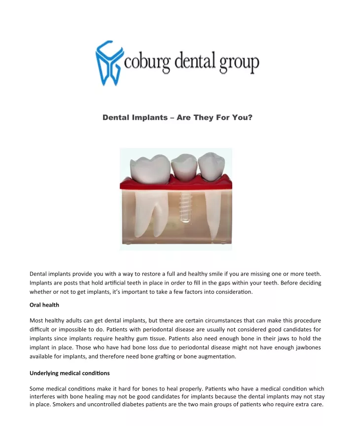 dental implants are they for you