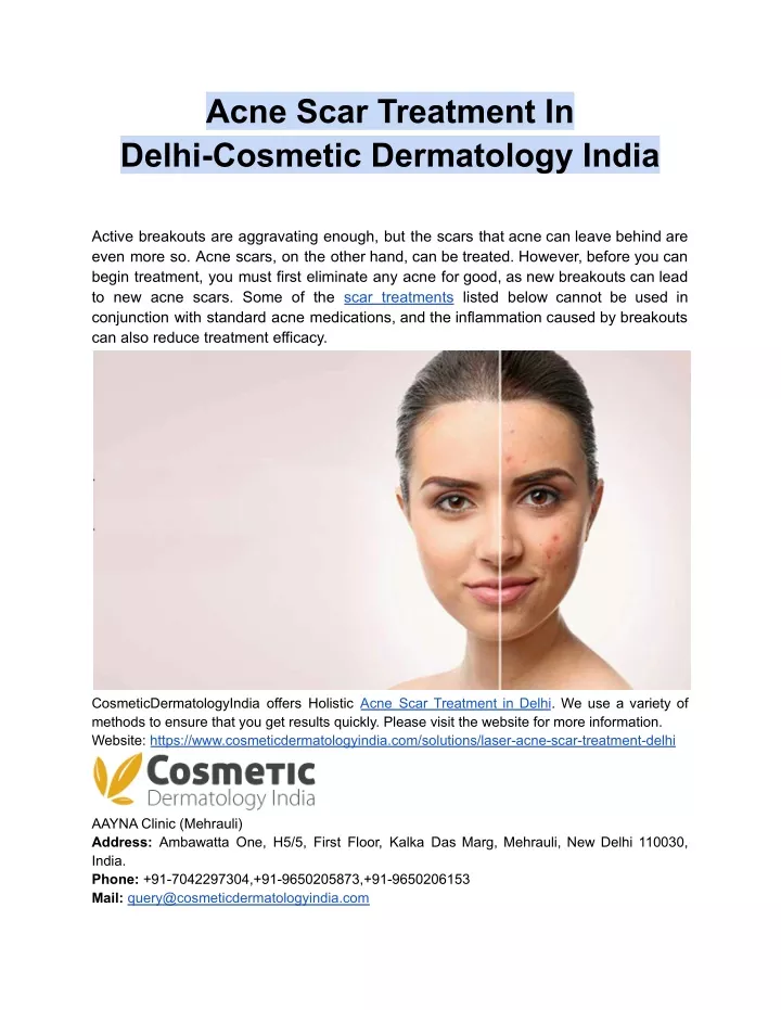 Ppt Acne Scar Treatment In Delhi Cosmetic Dermatology India