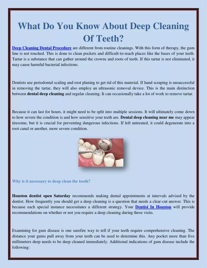 what do you know about deep cleaning of teeth