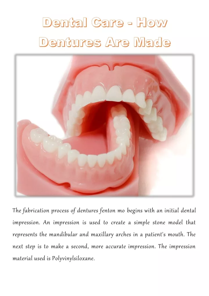 the fabrication process of dentures fenton