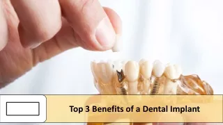 Top 3 Benefits of a Dental Implant in Toronto, ON