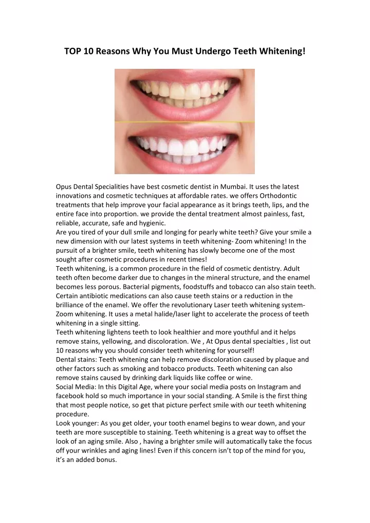 top 10 reasons why you must undergo teeth