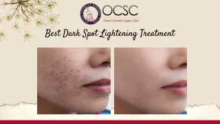 Best Dark Spot Lightening Treatment