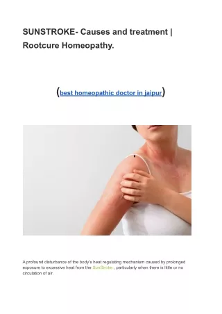 SUNSTROKE- Causes and treatment | Rootcure Homeopathy.