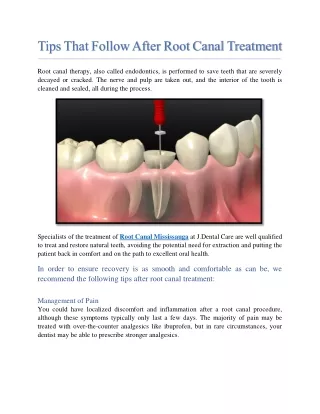 Tips That Follow After Root Canal Treatment