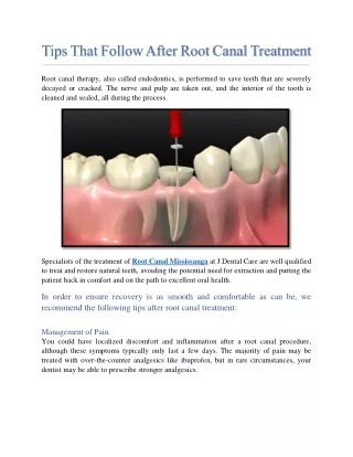 tips that follow after root canal treatment