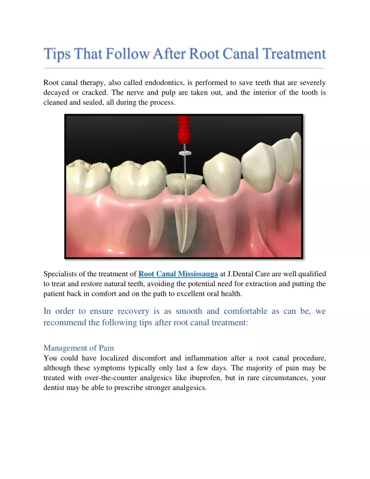 PPT - Tips That Follow After Root Canal Treatment PowerPoint ...