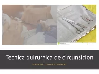 tecnica quirurgica de circunsicion