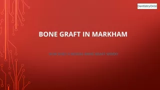 Bone Graft In Markham