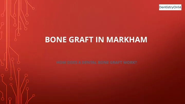 bone graft in markham