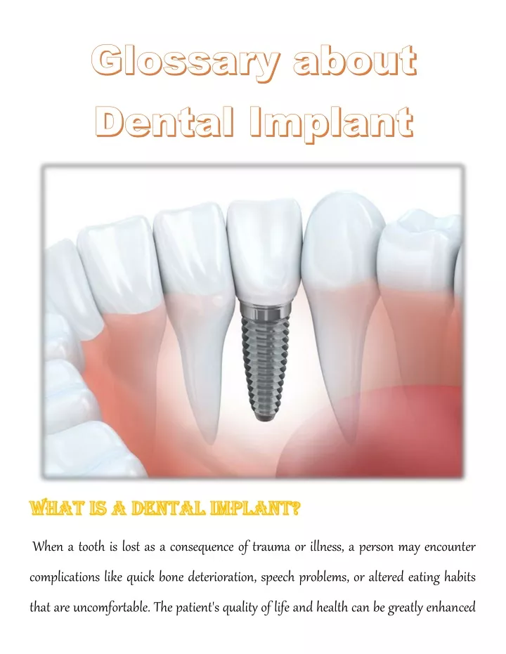 PPT - Glossary about Dental Implant PowerPoint Presentation, free ...