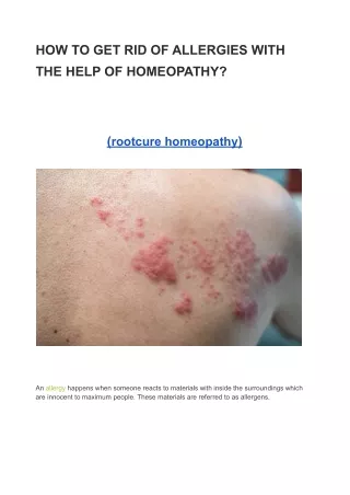 HOW TO GET RID OF ALLERGIES WITH THE HELP OF HOMEOPATHY?