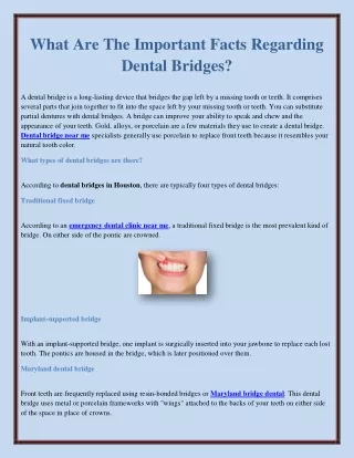 What Are The Important Facts Regarding Dental Bridges?