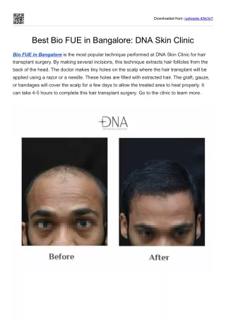 Best Bio FUE in Bangalore: DNA Skin Clinic