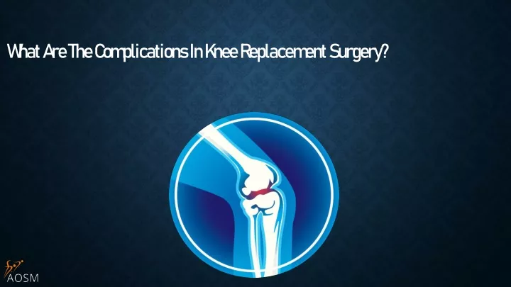 what are the complications in knee replacement surgery