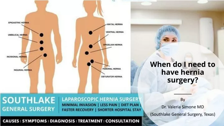 when do i need to have hernia surgery