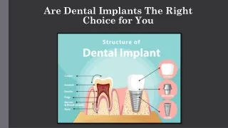 Are Dental Implants the Right Choice for You