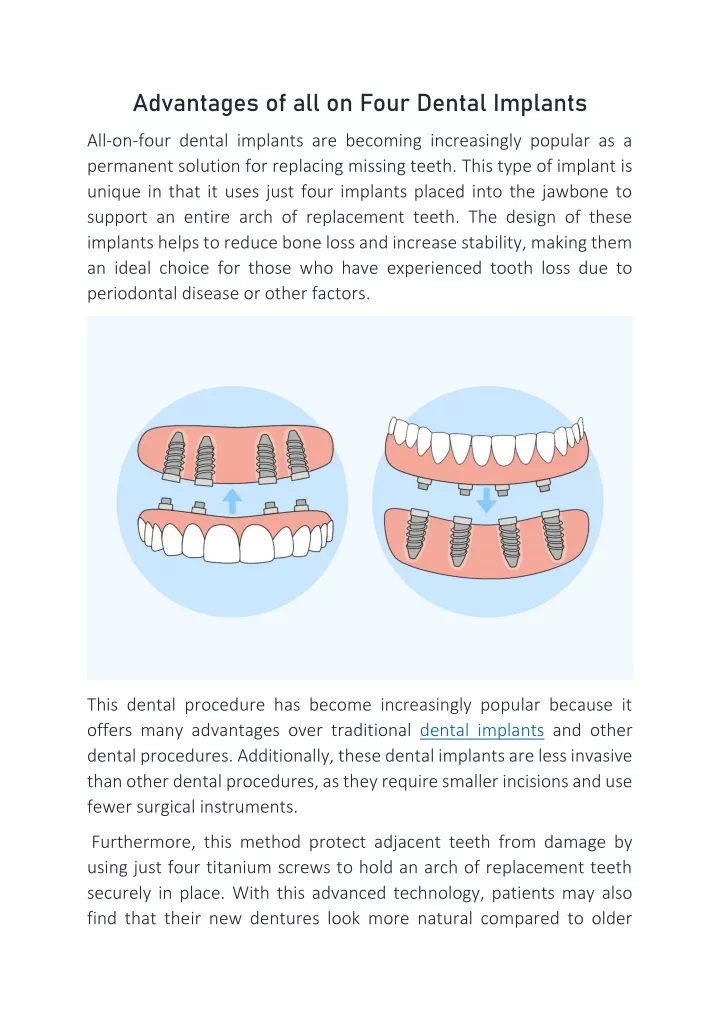 advantages of all on four dental implants