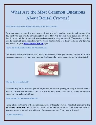 What Are the Most Common Questions About Dental Crowns?