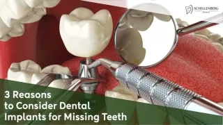 3 reasons to consider dental implants for missing