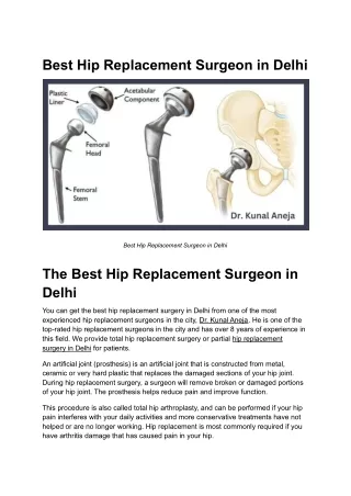 Best Hip Replacement Surgeon in Delhi