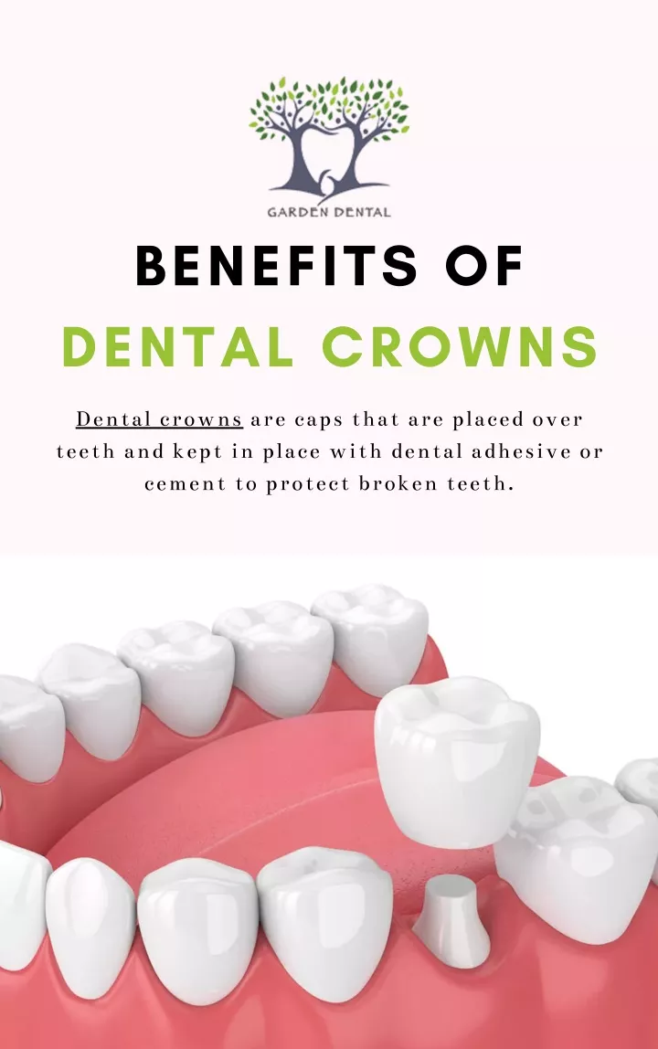 benefits of dental crowns