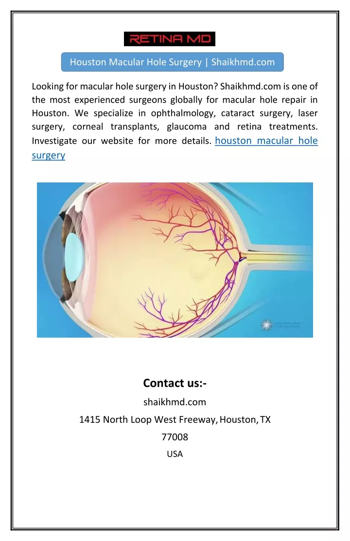 houston macular hole surgery shaikhmd com