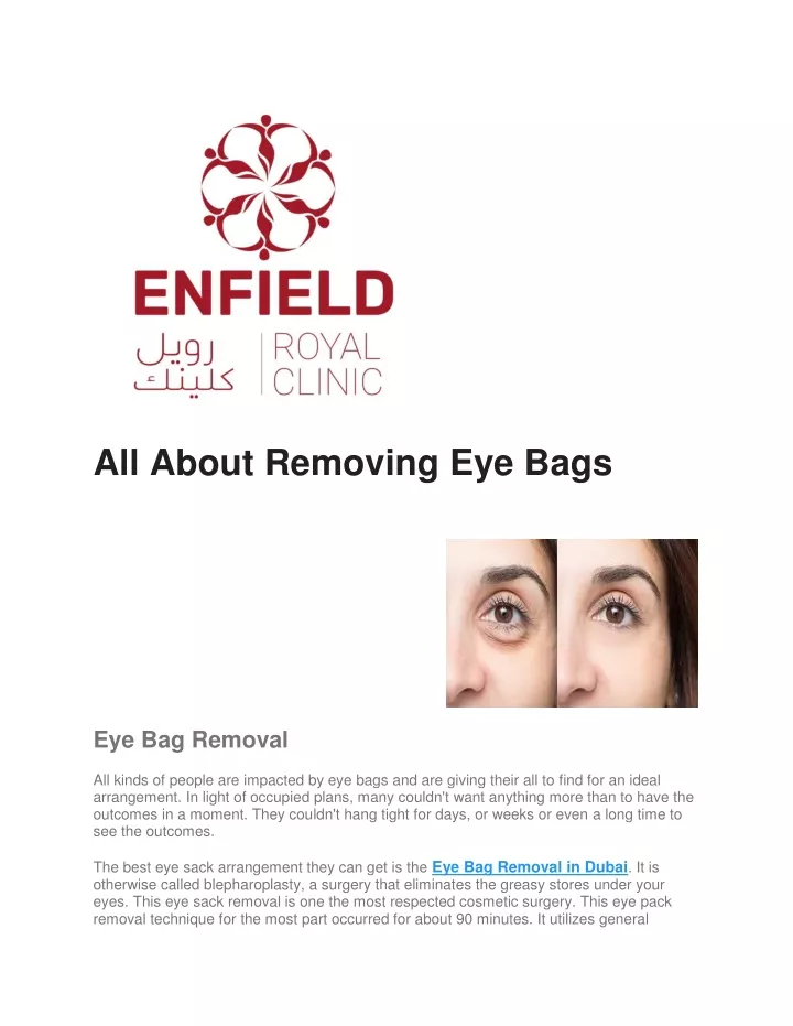 all about removing eye bags