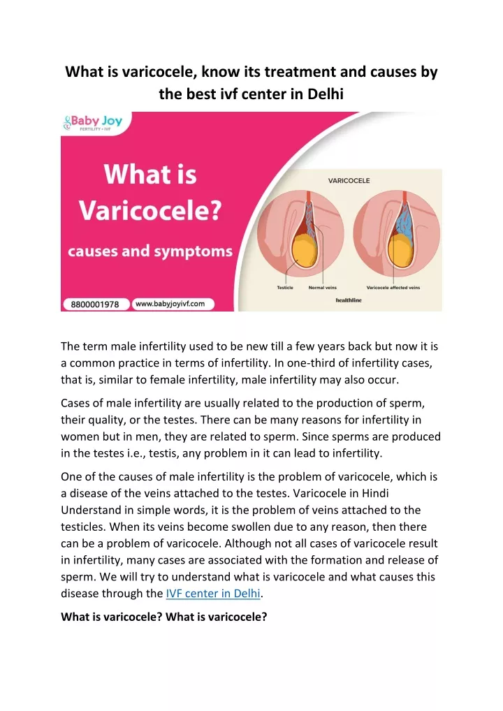 what is varicocele know its treatment and causes