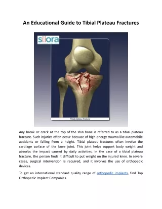 An Educational Guide to Tibial Plateau Fractures.docx